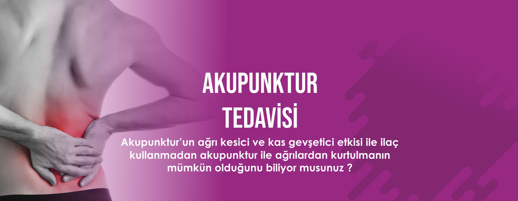 Akupunktur Tedavi